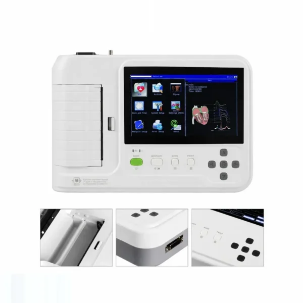Máy điện tim 6 kênh Contec ECG-600G – 12 đạo trình